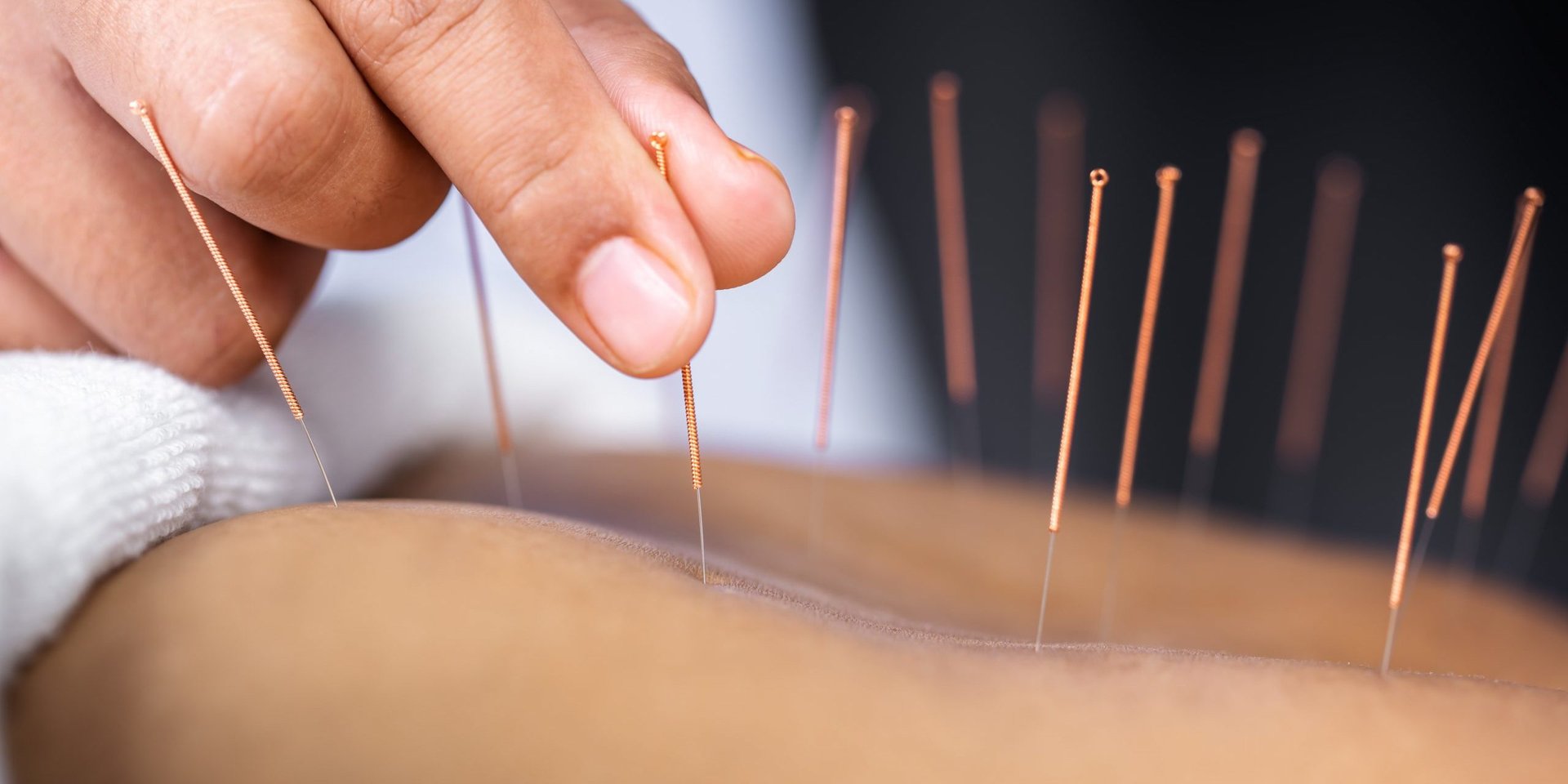 Leading Acupuncture